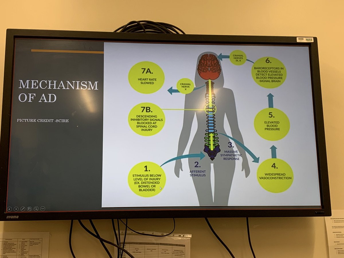 Rachel Jemmett (@rachel_jemmett) on Twitter photo Continuing with Spinal Injury Awareness week .. Dr Jav Haider talking about Autonomic Dysreflexia in Spinal Cord Injury <a href="/CV_UHB/">Cardiff and Vale University Health Board</a> <a href="/cavmtc/">CAVMTC</a> @UHWCriticalCare <a href="/TOCV12/">T&OC&V</a> @javRMEP <a href="/SWTraumaNetwork/">Wales Trauma Network</a> Continuing with Spinal Injury Awareness week .. Dr Jav Haider talking about Autonomic Dysreflexia in Spinal Cord Injury <a href="/CV_UHB/">Cardiff and Vale University Health Board</a> <a href="/cavmtc/">CAVMTC</a> @UHWCriticalCare <a href="/TOCV12/">T&OC&V</a> @javRMEP <a href="/SWTraumaNetwork/">Wales Trauma Network</a>