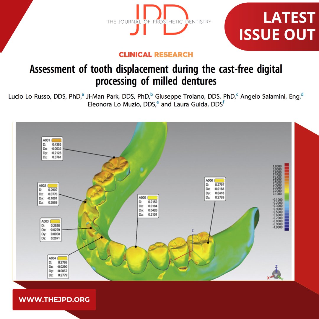 JPDentistry's tweet photo. #CADCAM #dentureteeth that have been bonded to a milled #denturebase are compared to the digital file to assess the positional accuracy when using a fully #digitalworkflow. Learn more from the latest issue of #theJPD: https://t.co/7G5rVe9vgF https://t.co/hgLm5jSzz6