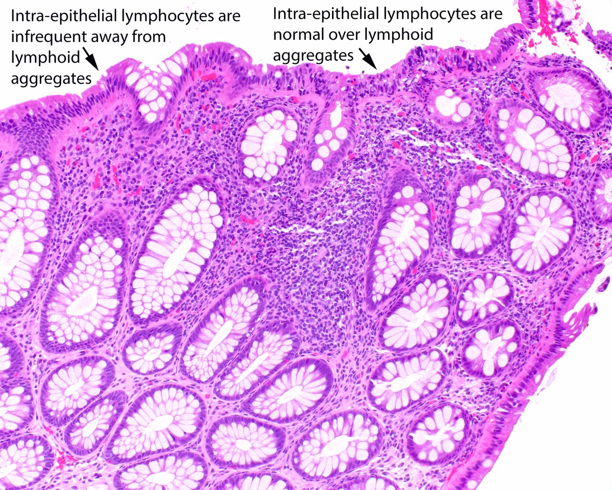 Jerad Gardner, MD on Twitter "RT LizMontgomeryMD Gastrointestinal