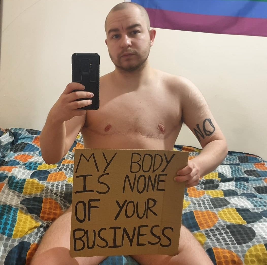 SkeletonOscar's tweet image. One more time for those at the back who haven't caught up yet. 

Trans rights are human rights. 

I'm a son. A brother. A grandson. A nephew. An uncle. A loving partner to my girlfriend.

A real human being, who just so happens to be trans - not an abstract concept to be debated.