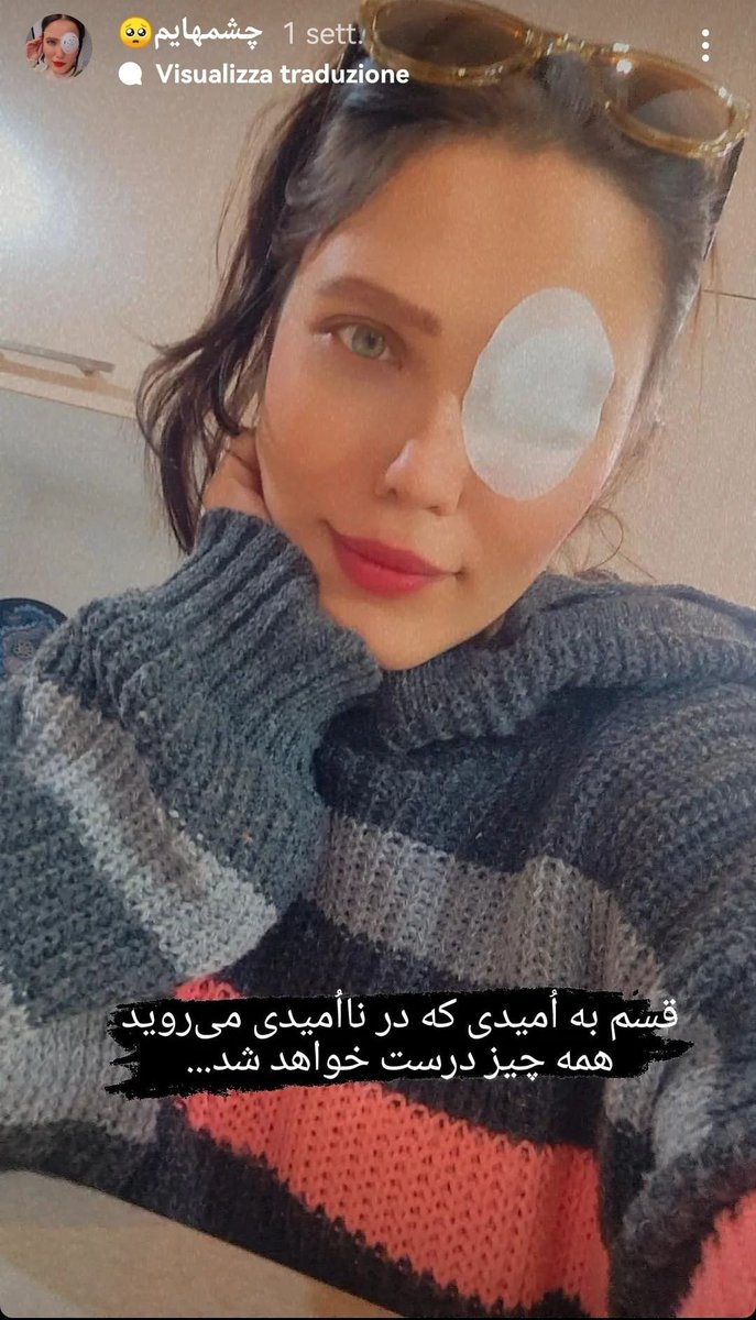 MarianoGiustino's tweet photo. Lei è #RahaleAmiri, una delle ragazze a cui i paramilitari delle #basij hanno sparato con un fucile da caccia in un occhio durante una sua partecipazione alla rivoluzione in corso. Non ha perso coraggio e continua a sostenere le rivolte antiregime in #Iran 

@RadioRadicale https://t.co/6RDDRQBeiF