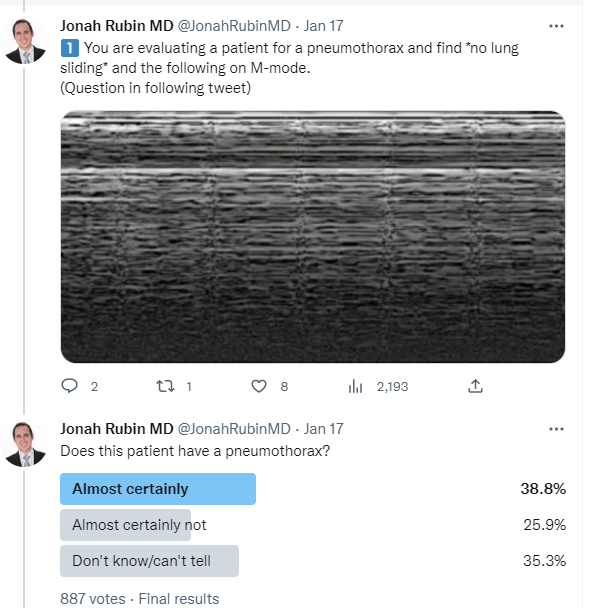 JonahRubinMD's tweet photo. Thoracic Ultrasonography!
...And the long-awaited answers to the 'simple' quiz.

The majority only got question #3 correct! 
40% needle-decompressed open lung. 
55% tapped ascites.
Let's fix that.

Read on: Crit Care Echo Lecture 6 
from @HarvardPulm @PCCSM_BIDMC @MGH_PCCM 🧵1/13 https://t.co/myE1CShffs
