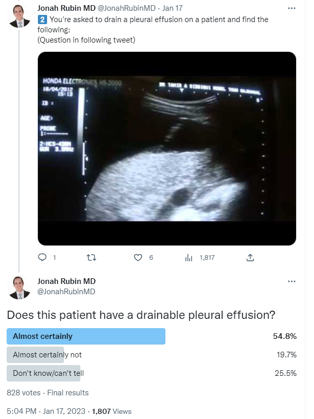 JonahRubinMD's tweet photo. Thoracic Ultrasonography!
...And the long-awaited answers to the 'simple' quiz.

The majority only got question #3 correct! 
40% needle-decompressed open lung. 
55% tapped ascites.
Let's fix that.

Read on: Crit Care Echo Lecture 6 
from @HarvardPulm @PCCSM_BIDMC @MGH_PCCM 🧵1/13 https://t.co/myE1CShffs