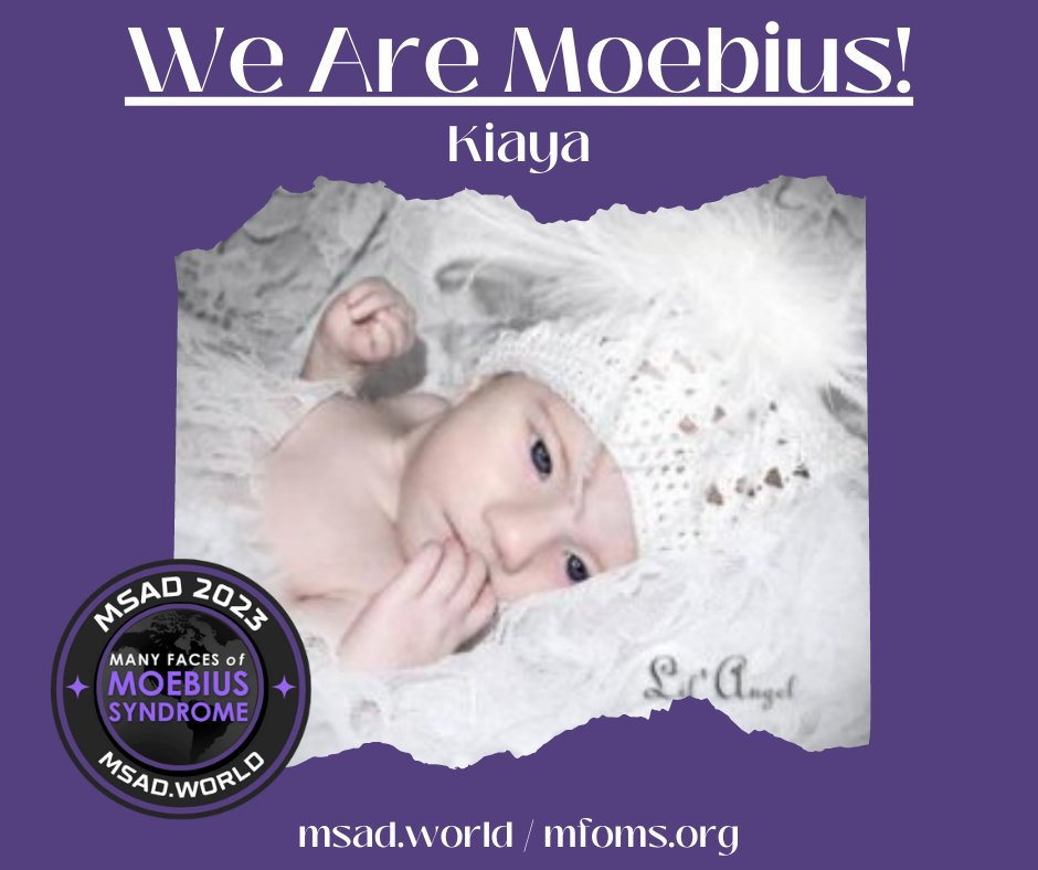 We are Moebius! Check out Kiaya's story at: moebiussyndromeawarenessday.com/about-5-26 Please Share! #mfomsfamily #moebiussyndrome #mfomsfamily #MSAD2023 #moebiussyndromeawareness #moebiussyndromeawarenessday #unitedstates