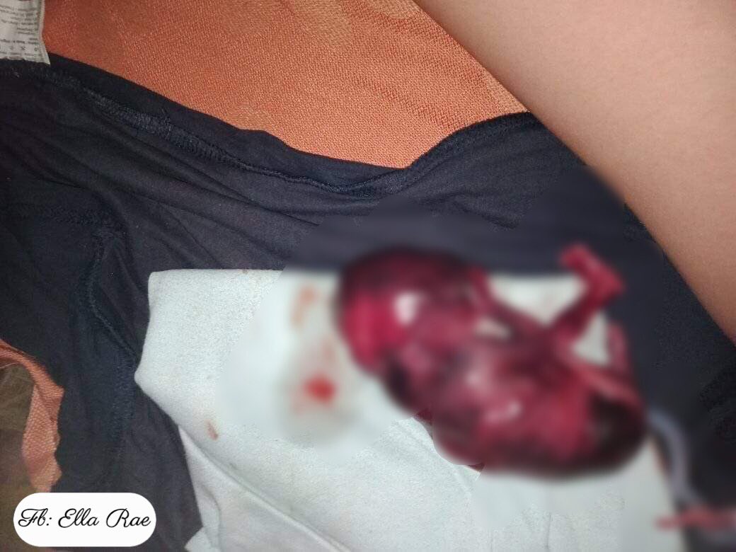 DAfterPill1's tweet photo. Yesterday’s proof of successful procedure!
Safe and Smooth process
Client’s information is strictly CONFIDENTIAL 
LEGIT SELLER SINCE 2010
DM for more INFO!! https://t.co/ZnYWAMvtqA