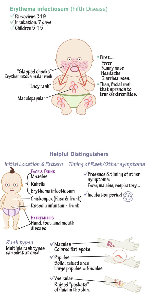 Sthanu on Twitter "Erythema Infectiosum fifth disease parvovirus B19