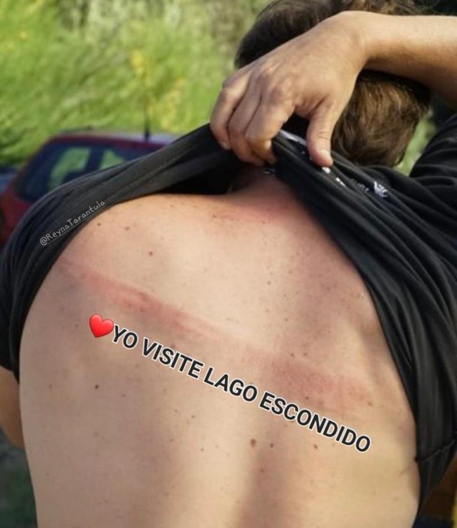 laricchiahugo's tweet photo. Parece que los kirchneristas cruzaron la linea de eucaliptos y los tatuaron en el sur. https://t.co/Sa6OamyeLn