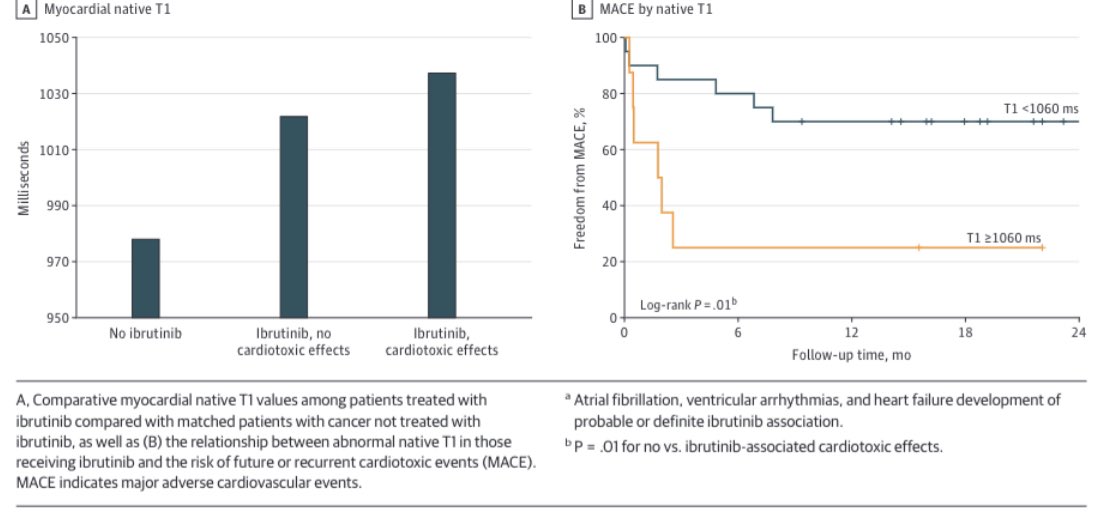 Daniel Addison, MD (@md_addison) on Twitter photo NEW: Cardiac MRI utility for Ibrutinib Cardiotoxicity
jamanetwork.com/journals/jamao…
*Cardiac injury (fibrosis) is prevalent, and predicts future cardiotoxic events in cancer patients*
Thanks to <a href="/JAMAOnc/">JAMA Oncology</a> for publishing this work.
#CardioOnc #hematology #CLL #Ibrutinib #WhyCMR NEW: Cardiac MRI utility for Ibrutinib Cardiotoxicity
jamanetwork.com/journals/jamao…
*Cardiac injury (fibrosis) is prevalent, and predicts future cardiotoxic events in cancer patients*
Thanks to <a href="/JAMAOnc/">JAMA Oncology</a> for publishing this work.
#CardioOnc #hematology #CLL #Ibrutinib #WhyCMR