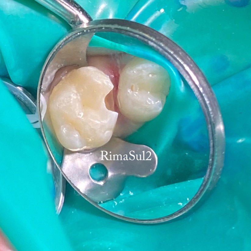 ريما tweet media