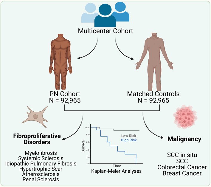 drshawnkwatra's tweet photo. In multi-center analysis, we find PN patients are at an increased risk of many CAF-malignancies including breast and colorectal cancer and squamous cell carcinoma as well as other fibrotic disorders (makes sense since CAFs are also present in PN non-lesional skin). https://t.co/XELaH4e2D9