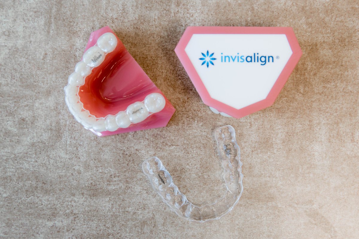 DonRobertsDDS's tweet photo. We know you'll be smiling more often when you start to see your teeth straighten out! #DKRDental #DCDentist #WashingtonDC #DentalCare #SmileGoals #dentist https://t.co/A1j9zFmlVV
