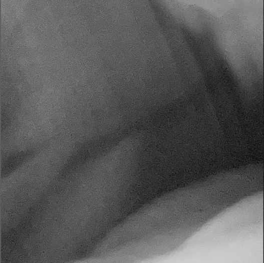 new release
-
skiing - modelomodelomodelo ep
open.spotify.com/album/2ZbjbYVI…