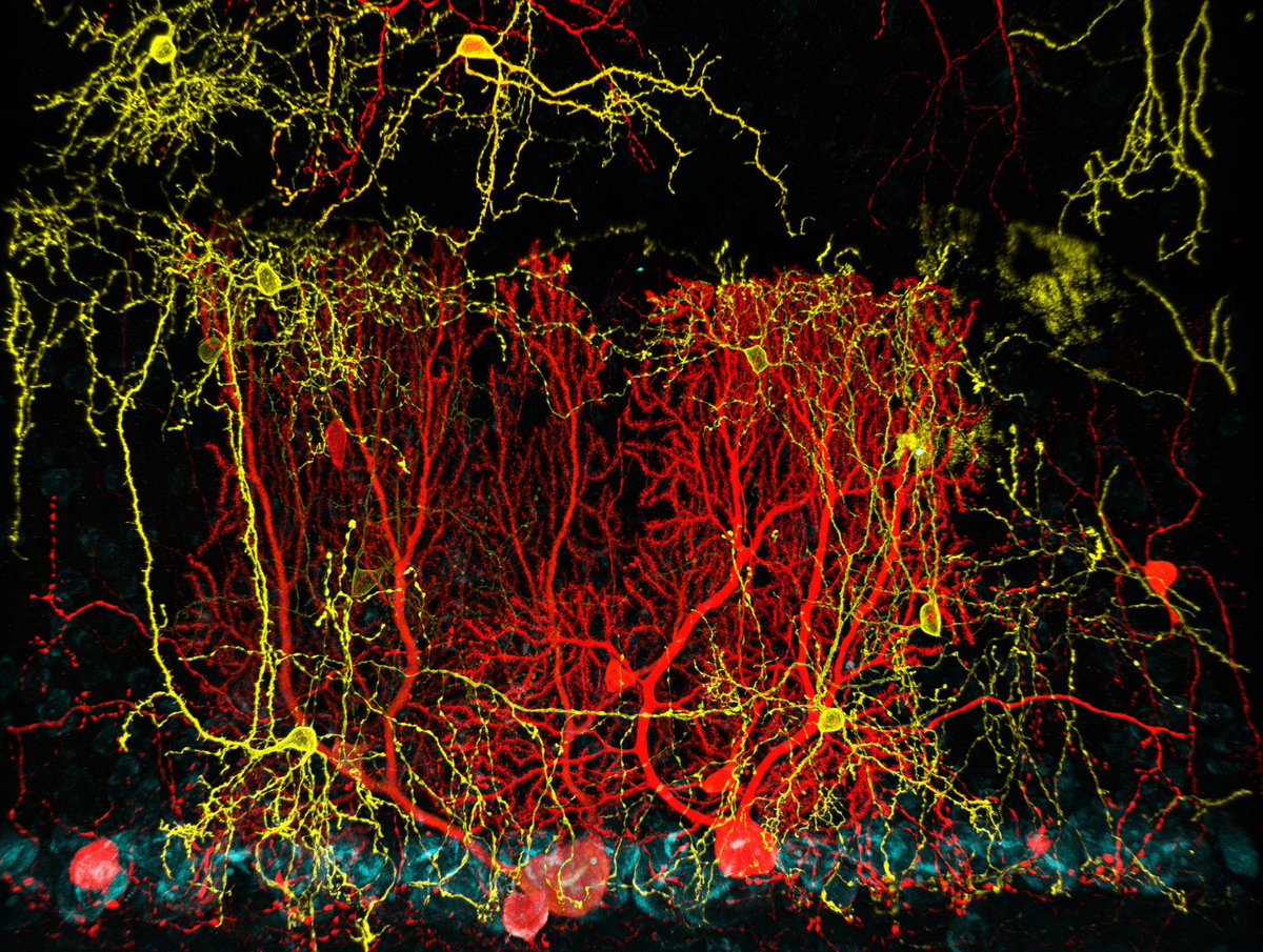 We recently concluded our Microscopy Image Contest and just wanted to take a second to highlight our finalists!

In first place was Wendy Wang at University of Toronto with an image of interneurons in a mouse cerebellum labeled with membrane-targeted fluorescent proteins: