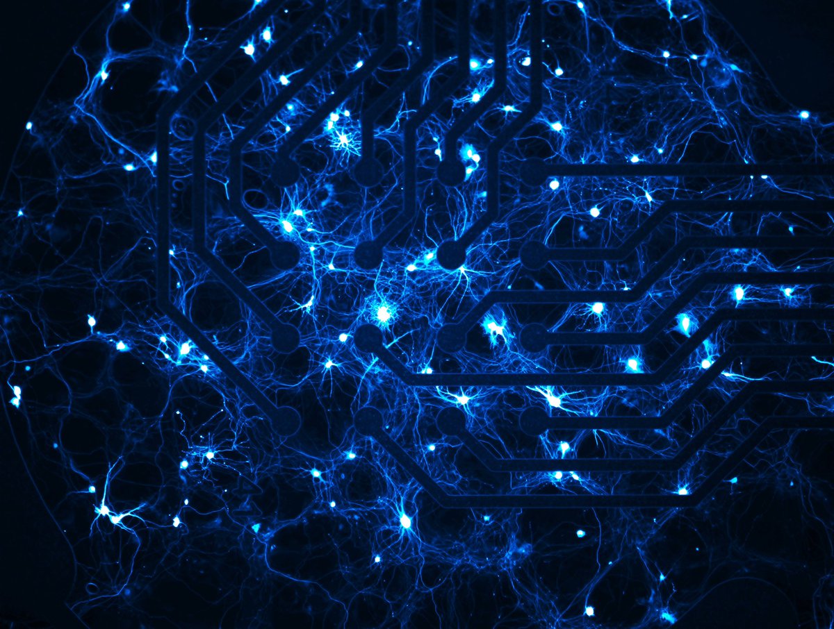 Our second place finalist was Lauren Rylaarsdam at Northwestern University, showing excitatory neurons on a multielectrode array: