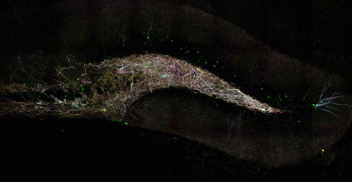 And in third place we had Frank Raven at Univeristy of Michigan with a Brainbow image of dentate gyrus in a mouse hippocampus: