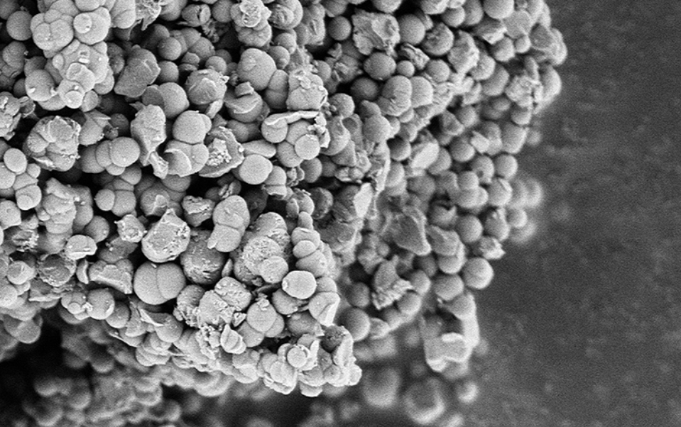 Speciale biomaterialen die tegelijkertijd sterk zijn, botherstel stimuleren en kankercellen aanvallen: dat is waar onderzoekers in Maastricht de komende jaren aan gaan werken. Je hoort er meer over in #wetenschapvandaag bnr.nl/podcast/wetens…