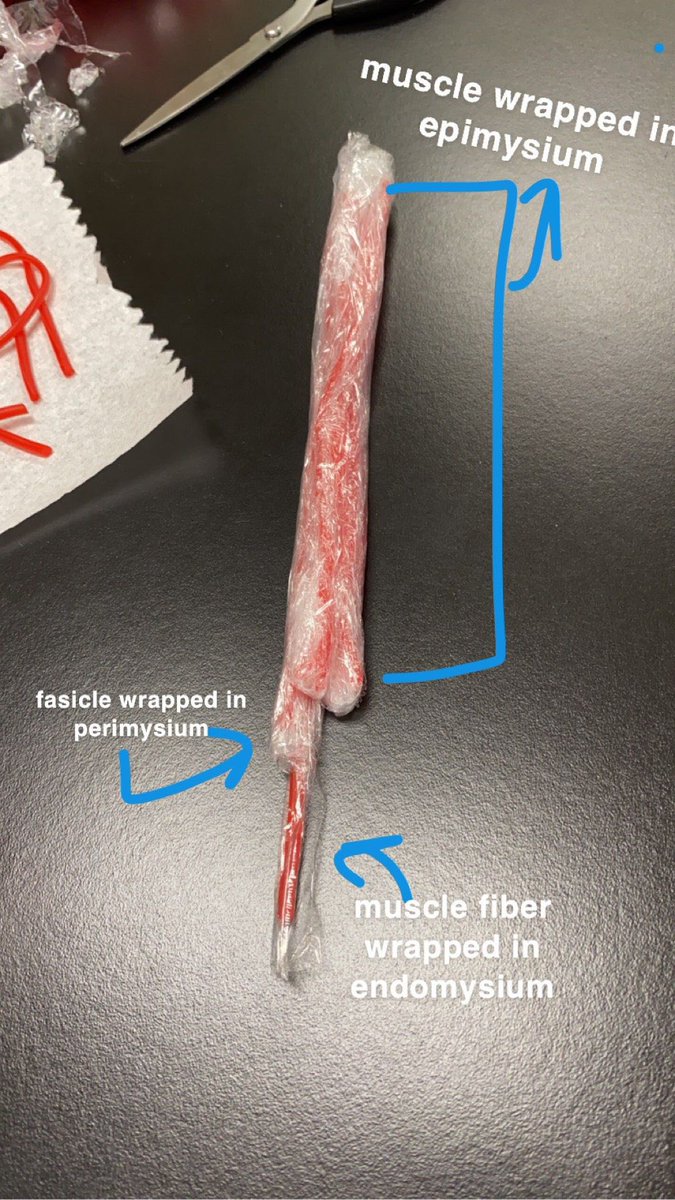 sarahnethero's tweet photo. Using Twizzlers and plastic wrap to model skeletal muscles and their connective tissues #netheroanatomy #muscularsystem #musclefiber #handsonlearning https://t.co/0XrViuNocQ