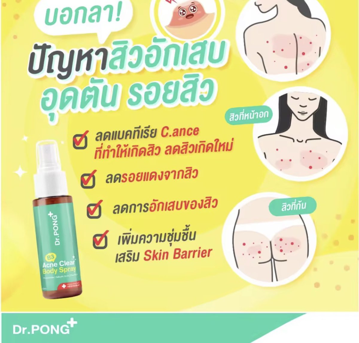 Forrain's tweet photo. รีวิว ใช้ดีบอกต่อ สเปรย์ฉีดสิวที่หลังของ Dr.Pong คือเราเป็นคนนึงที่สิวที่หลังเยอะโคตร ปรากฎใช้มาสักพักแล้วสิวจางลงไปเยอะมาก ทำให้มั่นใจเวลาใส่เสื้อผ้าขึ้นเยอะเลยอะ ใครสิวที่หลังเยอะแบบเรา ไปเลย ไปตำ มันเวิคจริง

พิกัด 💙 https://t.co/Ljz6hwktGK
#รีวิวLazada https://t.co/KCB5wf06aK