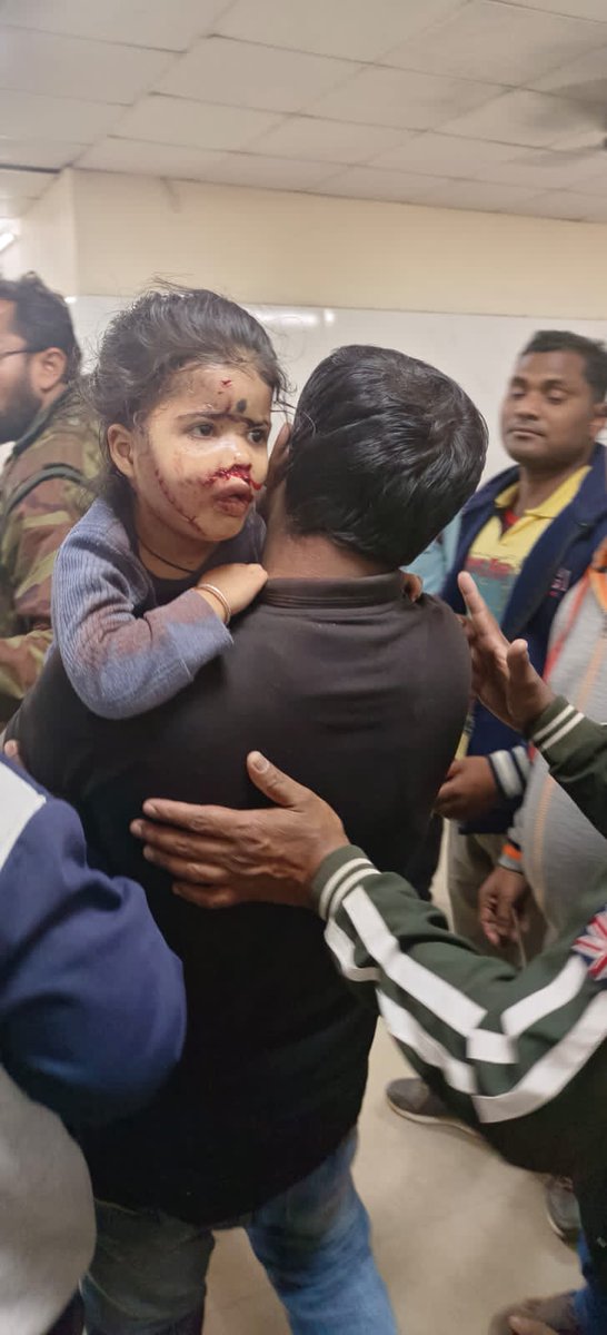 Mohanty09Tapas's tweet photo. This incident took place at around 8 pm today in Shantipara of Balangir district, 3 members of a family including a child were beaten after entering the house. This shows how safe Balangir is ?! @CMO_Odisha @MoSarkar5T @spbalangir @CollectorBgr @NarasinghMishra https://t.co/iErhYlDSX5