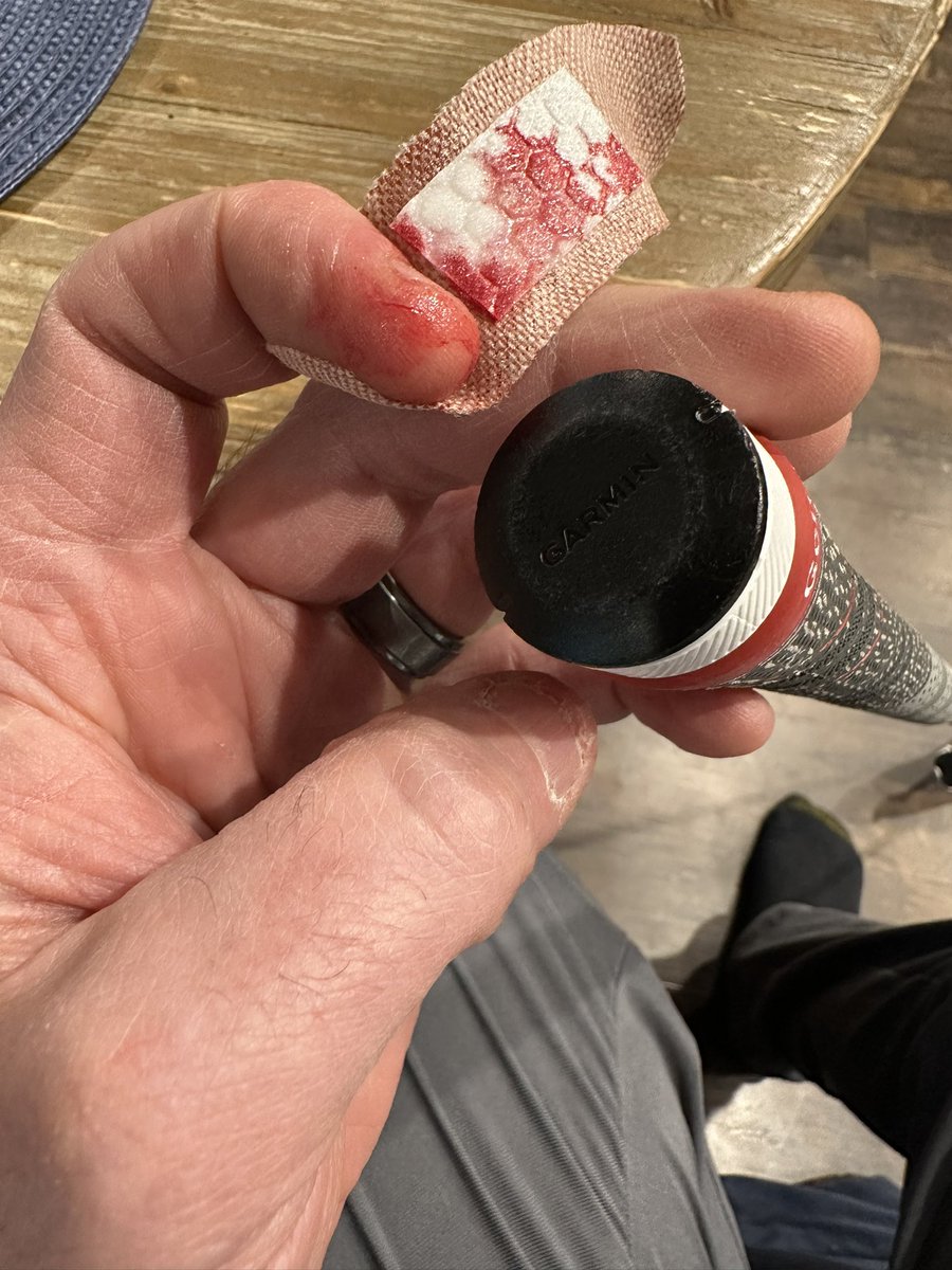 Kyle49ers's tweet photo. Hey @Garmin , thanks for not including a battery cap removal tool in the Approach CT10 sensors box. 🤨 https://t.co/Hr8xUcVYBt