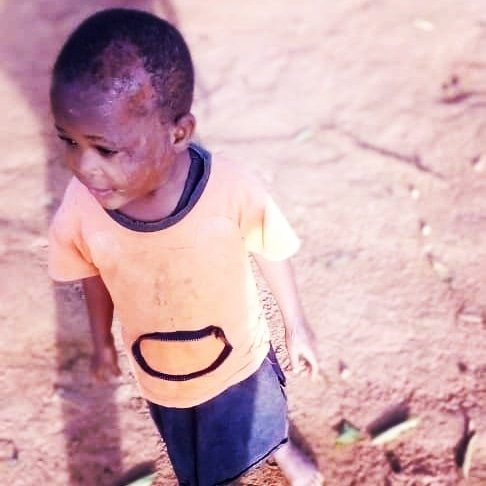 ImageAids's tweet image. Please let us help such people because no one chose to be an orphan