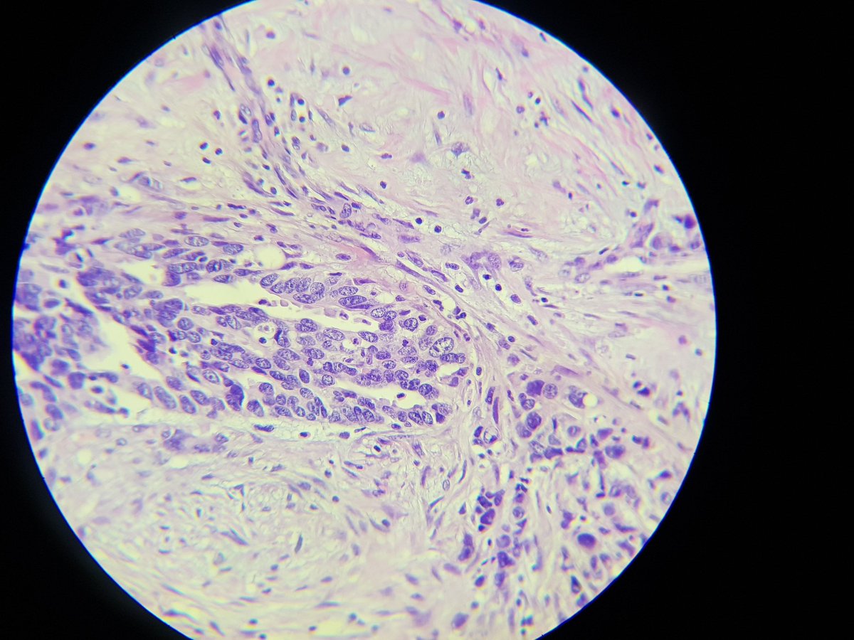 AlaaRowaid_88's tweet photo. Omental mass ,
Please any idea about primary site?
#Help
#pathtweet
#GITpath https://t.co/YYR0YEmRFK