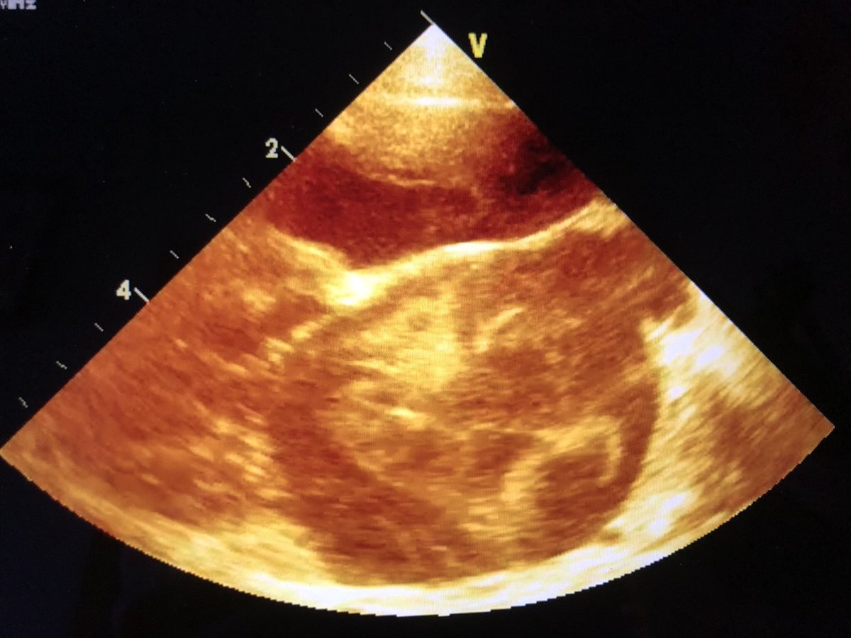 Smoke(d) Chicken :) 
cat with HCM and severe LAE
#echofirst #vetcardio