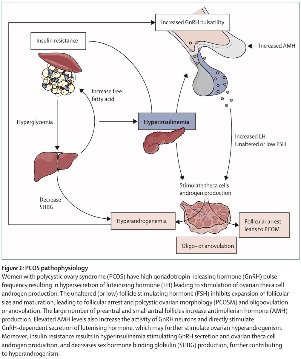 Mauricio Ambriz on Twitter "Fisiopatología del SÍNDROME DE OVARIO