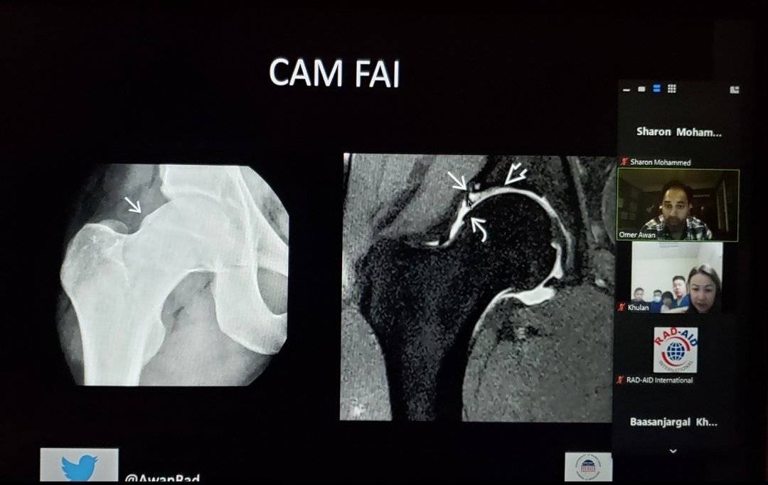 Sharon Mohammed BSMI, RT(R)CT, ARRT tweet media
