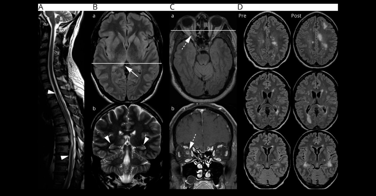 Neurology Journal tweet media