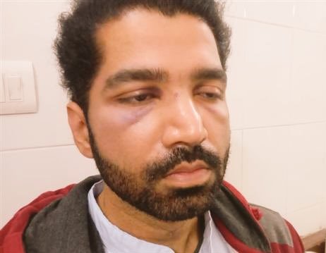 Indian__doctor's tweet photo. Dr Raovarinder Singh
was on emergency shift at Rajindra Hospital, #Patiala saving a critical patient when he saw 6 miscreants misbehaving with nurses for early treatments!

He saved nurses but got multiple facial ,nasal injuries
Have Doctors any Rights of Protection?
#MedTwitter https://t.co/ZCsmRKB6PV