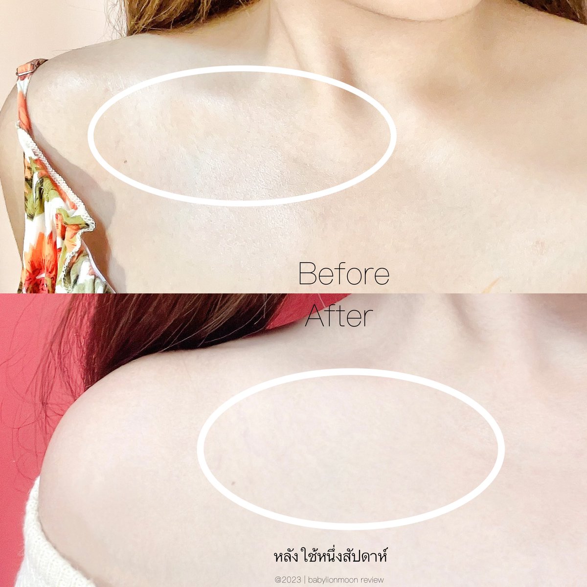 JA_quip's tweet image. #VaselineGlutaHya สูตรใหม่ Pro-Age คือชอบเนื้อครีมแบบ 3,000% เลย🛋️ นิ่มละมุน มีกลิ่นหอมอ่อนๆ ตัวนี้ช่วยเรื่องผิวกระชับ ลดจุดด่างดำ ผิวนุ่มชุ่มชื้น อิ่มฟู✨ ใช้มาประมาณอาทิตย์นึงรู้สึกเลยว่าผิวละมุนขึ้น ฉ่ำโกลว์ ริ้วรอยลดลงไปนิดนึง 👉🏻👈🏻 ไปซื้อหลอดใหญ่มารอใช้รอแล้ววว  #วาสลีนตัวตึง