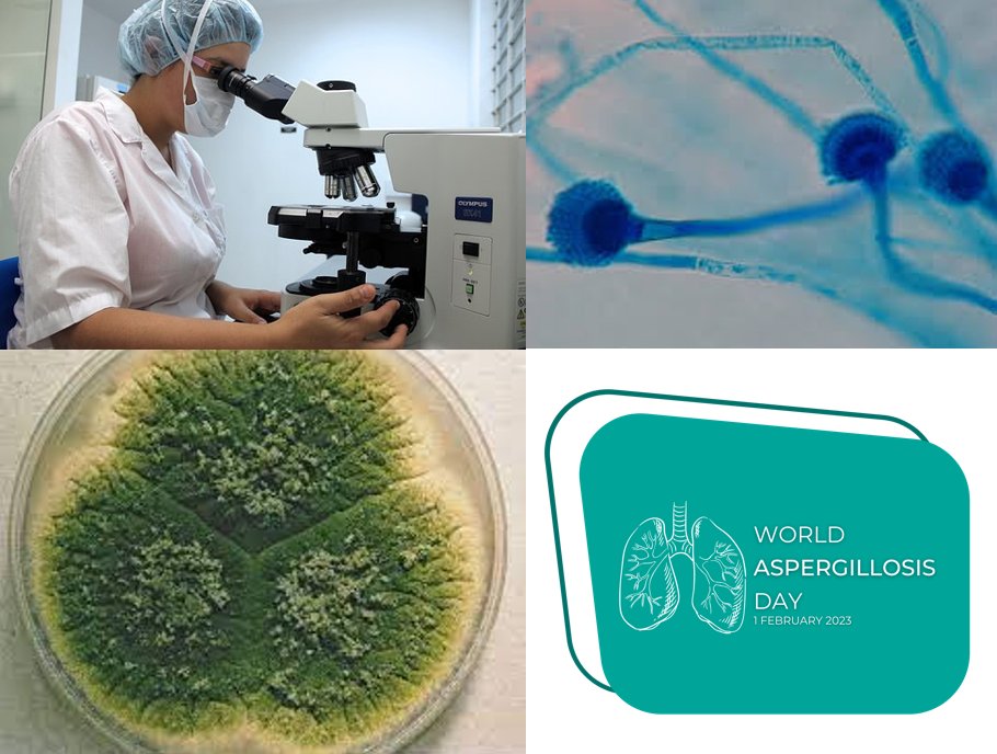 beth_nac's tweet photo. Today is #WorldAspergillosisDay but how much do you know about #laboratory tests for Aspergillus mould? 🧑🔬🔬🧫Comment with your own fungal factoids
#idtwitter #medtwitter #microbiology #pathogen #webms #medicaleducation #meded #fungal #mycology #Health #diagnostics #wad2023 https://t.co/8th6PKUI7o
