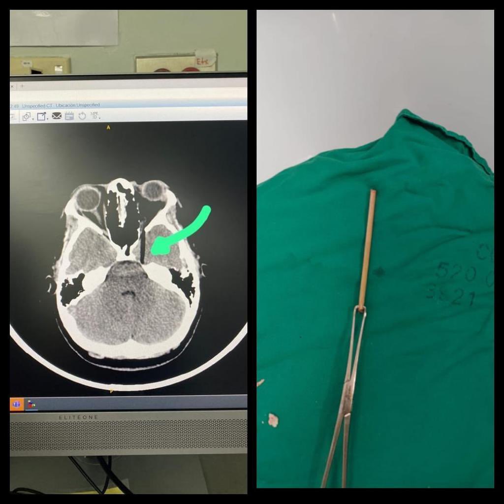 Isaescorihuela tweet media