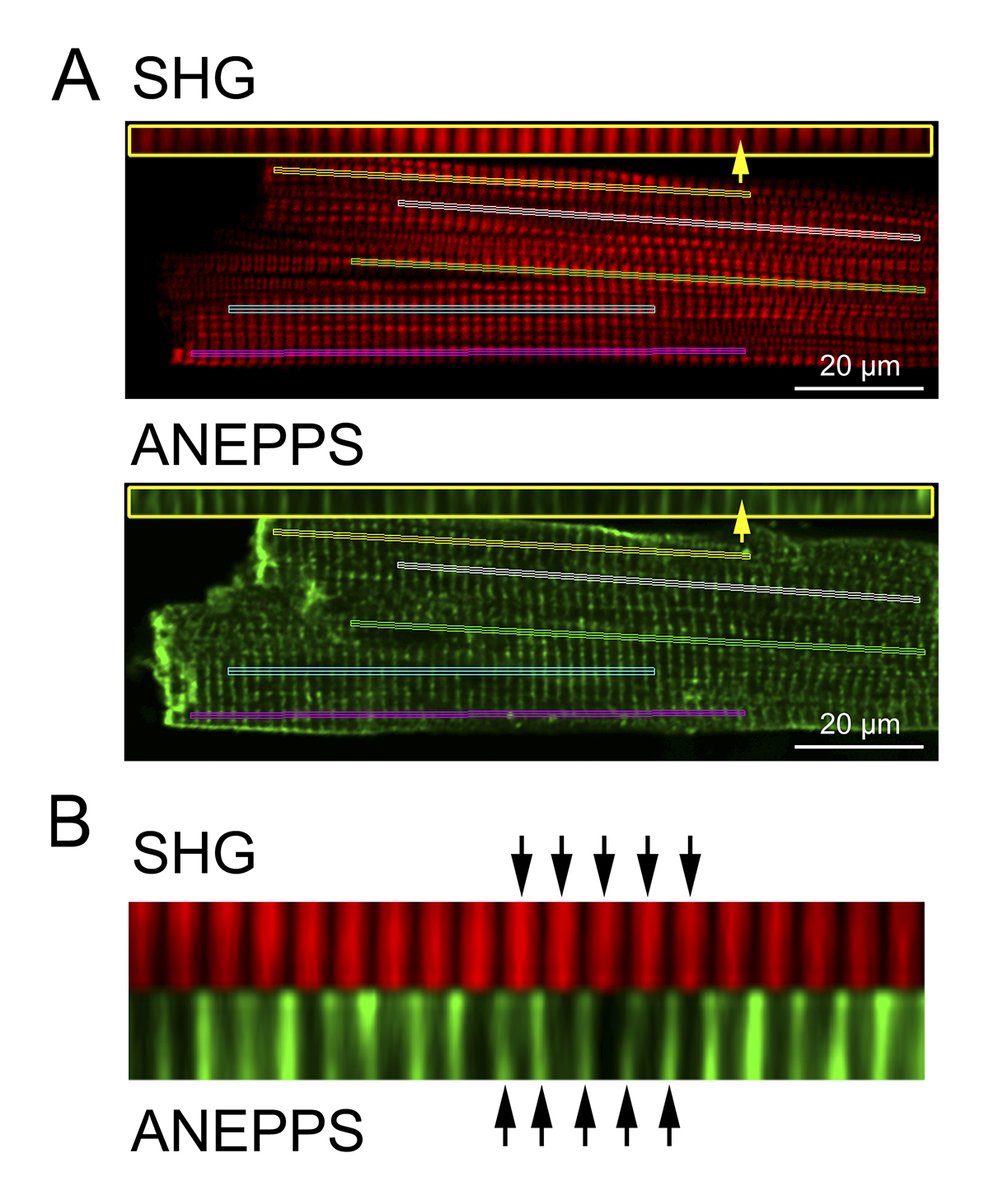 JGenPhysiol's tweet photo. Cardiomyocyte sarcomere length variability: Membrane fluorescence versus second harmonic generation myosin imaging. A new study from Oleg Lookin, Pieter de Tombe, Olivier Cazorla @umontpellier and colleagues https://t.co/rbvKnZ2HIW
#CellMotility #MyofilamentFunction #Biophysics https://t.co/aovh3wdQT9