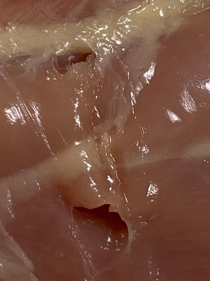Ron Barbosa MD FACS on X: However, biting down on tissue but not cutting  it may not be *totally* without consequence. Here I have decided not to  divide the tissue bridge. You