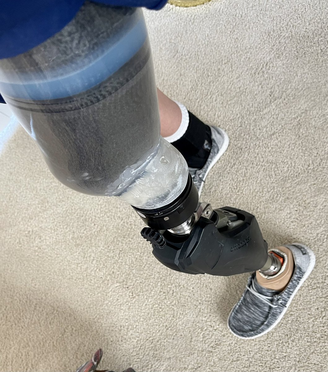 NoLimitsCharter's tweet photo. New acrylic to field trial… looking forward to getting the carbon fiber prosthetic socket soon! #reelpirate #lindhextend @OPCenters #lindhefoot #prosthesis #prostheticsocket #livelifewithnolimits @OttobockUS_CA https://t.co/TmDB36wXJt