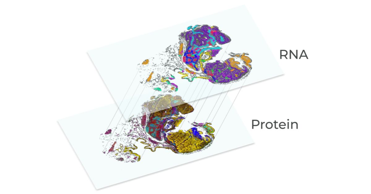 AkoyaBio's tweet photo. We're excited to present results from a novel same-section, #spatialmultiomic study at #AGBT23! Learn how imaging #RNA & protein #biomarkers simultaneously, in a single tissue section, can give a more complete picture of tumor biology. https://t.co/vlAYzY9L7l
@agbt #genomics https://t.co/hmlttwp90c
