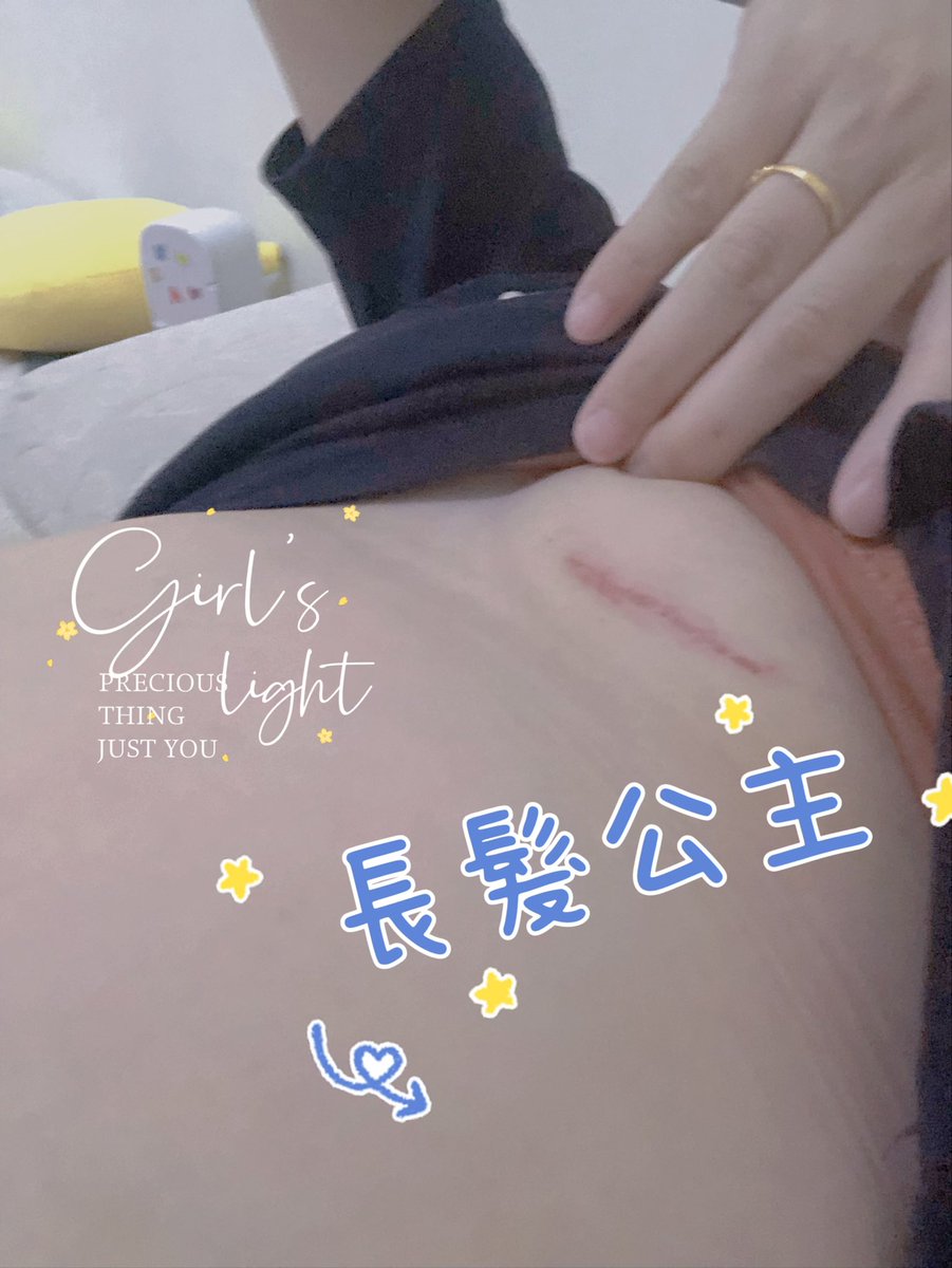 Mini5201314's tweet photo. 天啊，這是怎麼了？
😱😱😱 https://t.co/coPxsr5KgV