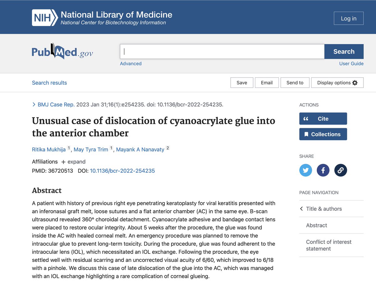 NanavatyMA's tweet photo. This article shows tips to manage an inadvertently placed cyanoacrylate glue inside the eye. Thanks to @dr_ritika_eye; @MaytyraPhoto . #glue; #cornea; #perforation. @BMJCaseReports; @RCOphth; @ESCRSofficial; @ASCRStweets; @aao_ophth; @UKISCRS; @AECOSurgery https://t.co/SfvPh23KaV