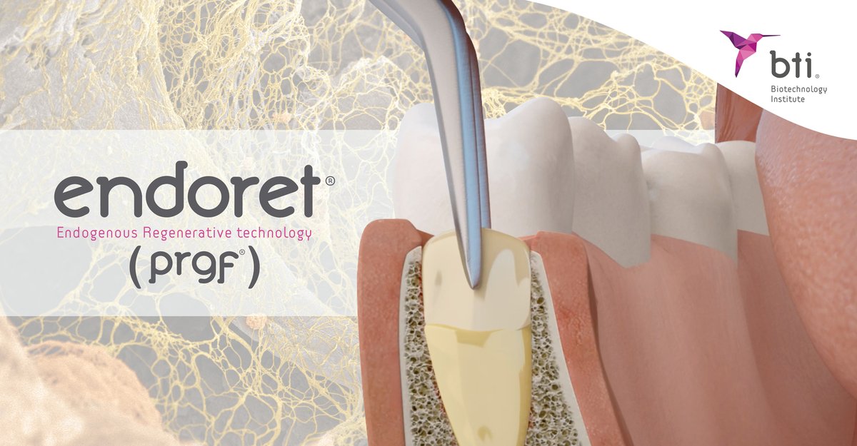 BTIBiotech's tweet photo. ¿Conoces PRGF-ENDORET®? Una tecnología biomédica de gran versatilidad que permite su uso en el tratamiento de muy diversas patologías e intervenciones clínicas dentro del ámbito de la cirugía oral y maxilofacial. Más información aquí 👉 https://t.co/YzkLE4juiD #PRGF #Endoret https://t.co/oxoy2u203t