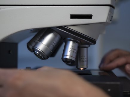 FranceNews24's tweet image. 🔴 INFO - #Santé : Un #virus a infecté une patiente de 61 ans et lui a provoqué une hépatite. Ce virus jusque-là inconnu, de la famille des #circovirus, vient d’être identifié par des scientifiques français et a été provisoirement baptisé Human Circovirus 1 (HCirV-1).