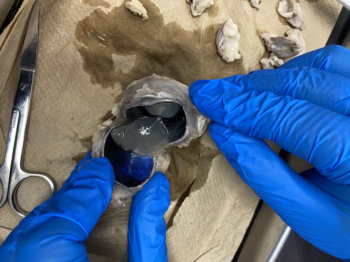 jos_valenzuela2's tweet image. 👁️Eye dissection in #drlunasclass @aluna0707