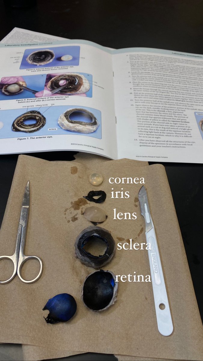 jos_valenzuela2's tweet image. 👁️Eye dissection in #drlunasclass @aluna0707
