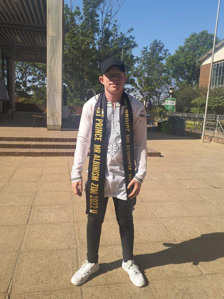 Bulawayo's own 1st Prince Mr and Miss Albinism 2022 Ntandoyenkosi Khabosie Mnkandla <a href="/Ntandoy53491692/">Ntandoyenkosi Mnkandla</a> to represent Bulawayo and Zimbabwe at the First ever Mr and Miss Albinism Southern Africa

<a href="/Sithand1844/">Sithandweyinkosi</a> <a href="/YPNZimbabwe/">YPNHW Zimbabwe</a> <a href="/Realbeefactor/">BrightoNcube</a> <a href="/TrustZim/">ALBINO TRUST OF ZIMBABWE</a> <a href="/TNHZ_Trust/">The Noble Hands Zimbabwe Trust</a> <a href="/DumisaniNgwesto/">Dumisani Ngwenya</a>