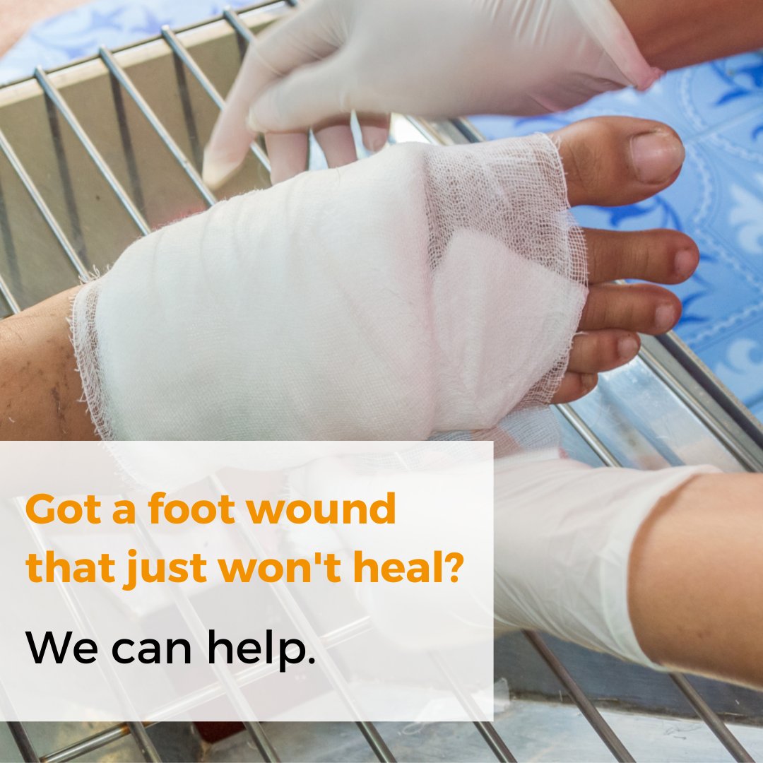 coronapodiatry's tweet photo. Do you have a #wound that refuses to heal? Are you also #diabetic? We can help you at Corona! A #footwound can be extra #scary and #painful for #diabetics, but you don't have to deal with it alone. Schedule an appointment for the care you deserve.

https://t.co/HScLdcdZD8 https://t.co/FXjHOz49fX