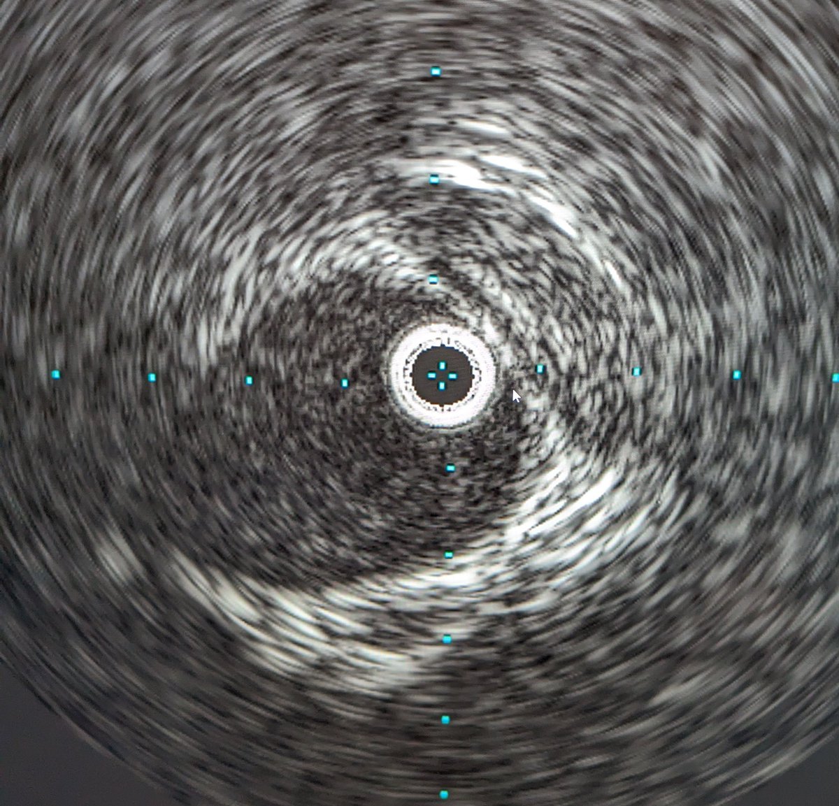 Mark Lessne, MD tweet media