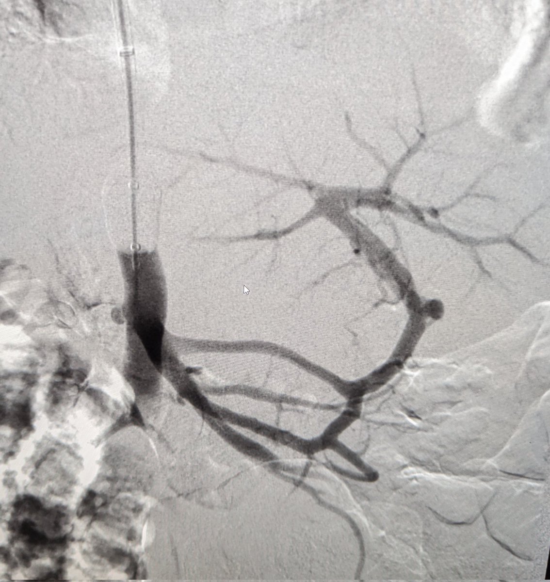 Mark Lessne, MD tweet media