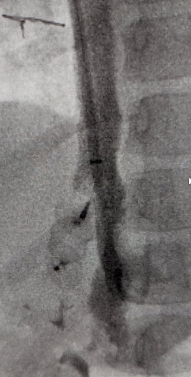 Mark Lessne, MD tweet media