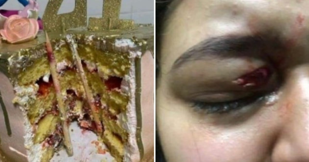 drrobertnunez's tweet photo. La tradicional e inocente broma donde aplastan la torta de cumpleaños por la cara resulta ser peligrosa para el festejado. 
No solo porque hay riesgo de asfixia sino también de sufrir heridas y requerir atención hospitalaria. https://t.co/diKJejHdMp